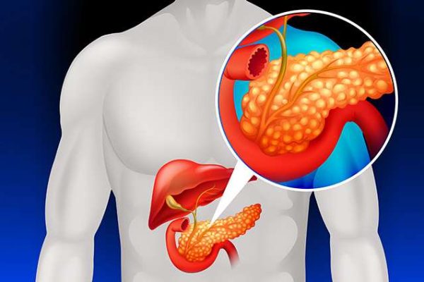 5 Tips Menjalani Hidup Sehat Setelah Diagnosis Pankreatitis 5 Tips Menjalani Hidup Sehat Setelah Diagnosis Pankreatitis