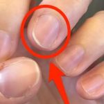 7 Cara Mendeteksi Masalah Kesehatan dari Warna Kuku