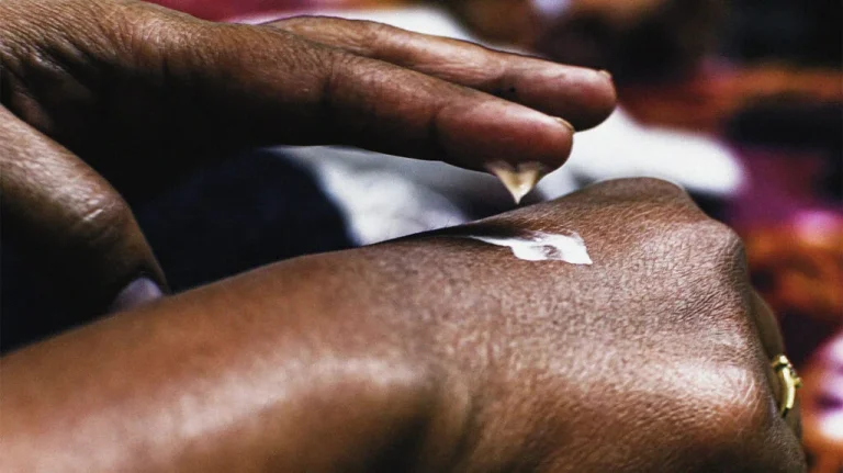 10 Cara Menghilangkan Bekas Luka dan Noda di Kulit