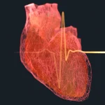 7 Tipe Makanan Cepat Saji yang Harus Dihindari oleh Penderita Jantung